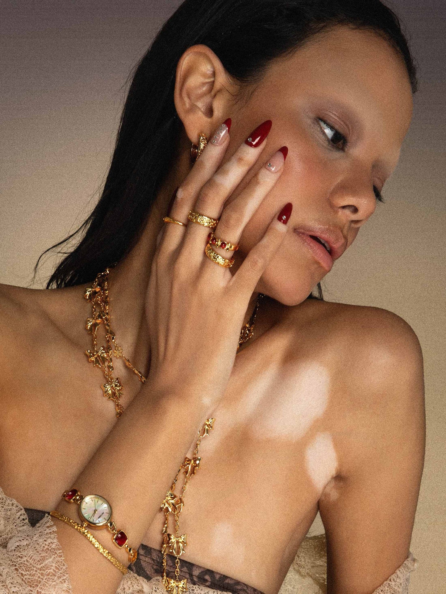 Serenade of Orchid Ring