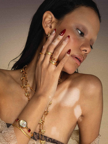 Serenade of Orchid Ring